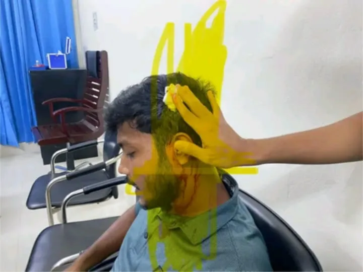 রাবিতে সাংবাদিকদের ওপর ছাত্রদল নেতা-কর্মীদের হামলা, চার সাংবাদিকসহ আহত ১০